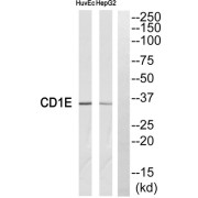 abx014939