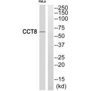 Western blot analysis of extracts from HeLa cells, using CCT8 antibody.