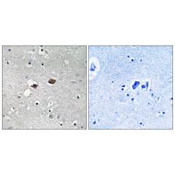 Tigger Transposable Element Derived 3 (TIGD3) Antibody