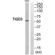 Western blot analysis of extracts from COLO205 cells, using TIGD3 antibody.