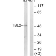 Western blot analysis of extracts from MCF-7 cells, using TBL2 antibody.