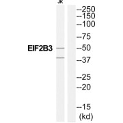 Eukaryotic Translation Initiation Factor 2B Subunit Gamma (EIF2B3) Antibody