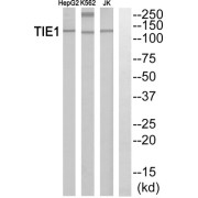 Western blot analysis of extracts from HepG2 cells, K562 cells and Jurkat cells, using TIE1 antibody.