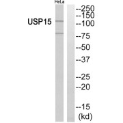 Western blot analysis of extracts from HeLa cells, using USP15 antibody.