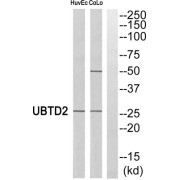 Western blot analysis of extracts from HuvEc cells and COLO cells, using UBTD2 antibody.