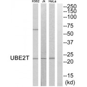 Western blot analysis of extracts from HeLa cells, Jurkat cells and K562 cells, using UBE2T antibody.