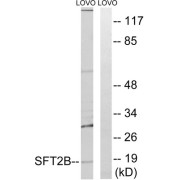 Western blot analysis of extracts from LOVO cells, using SFT2B antibody.