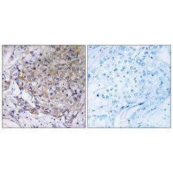 WAS Protein Family Member 3 (WASF3) Antibody