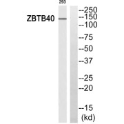 Western blot analysis of extracts from 293 cells, using ZBTB40 antibody.