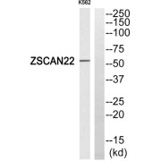 Western blot analysis of extracts from K562 cells, using ZSCAN22 antibody.