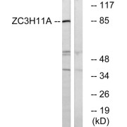 Western blot analysis of extracts from COS cells, using ZC11A antibody.