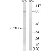 Western blot analysis of extracts from HepG2 cells, using ZC3H8 antibody.