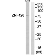 Western blot analysis of extracts from K562 cells, using ZNF420 antibody.