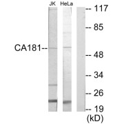 Western blot analysis of extracts from Jurkat cells and HeLa cells, using CA181 antibody.