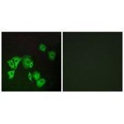 Immunofluorescence analysis of A549 cells, using TTF2 antibody.