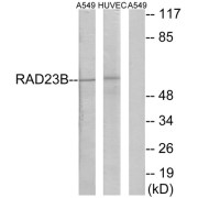 Western blot analysis of extracts from A549 cells and HUVEC cells, using RAD23B antibody.