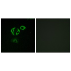 Transforming Acidic Coiled-Coil-Containing Protein 3 (TACC3) Antibody