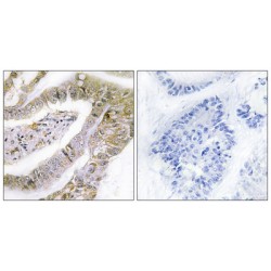 Transforming Acidic Coiled-Coil-Containing Protein 3 (TACC3) Antibody