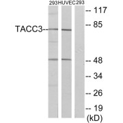 Western blot analysis of extracts from 293 cells and HUVEC cells, using TACC3 antibody.