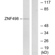 Western blot analysis of extracts from COS-7 cells, using ZNF498 antibody.