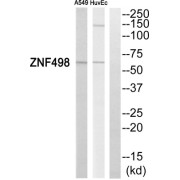 Western blot analysis of extracts from A549 cells and HuvEc cells, using ZNF498 antibody.