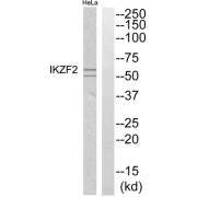 Western blot analysis of extracts from HeLa cells, using IKZF2 antibody.