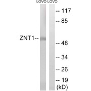 Western blot analysis of extracts from LOVO cells, using SLC30A1 antibody.