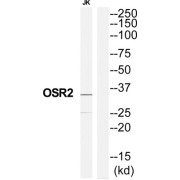 Odd-Skipped Related Transciption Factor 2 (OSR2) Antibody