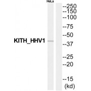 Western blot analysis of extracts from HeLa cells, using Thymidine kinase antibody.