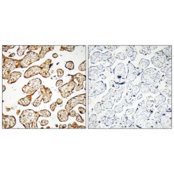 Bifunctional UDP-N-Acetylglucosamine 2-Epimerase/N-Acetylmannosamine Kinase (GNE) Antibody