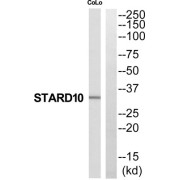 StAR-Related Lipid Transfer Protein 10 (STARD10) Antibody