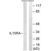 Western blot analysis of extracts from COLO cells, using IL15RA antibody.