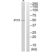 Western blot analysis of extracts from Jurkat cells, using IFIT5 antibody.