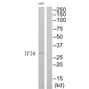 Interferon Alpha Inducible Protein 6 (IFI6) Antibody