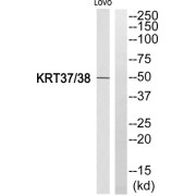 Western blot analysis of extracts from LOVO cells, using KRT37/38 antibody.