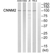 Western blot analysis of extracts from Hela cells, K562 cells, Jurkat cells and A549 cells, using CNNM2 antibody.