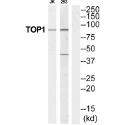 Topoisomerase I (TOP1) Antibody