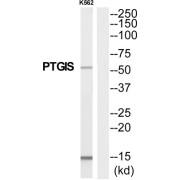 Prostaglandin I Synthase (PTGIS) Antibody