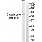 Western blot analysis of extracts from HeLa cells, using Cytochrome P450 4F11 antibody.