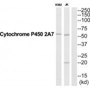 Cytochrome P450 Family 2 Subfamily A Member 7 (CYP2A7) Antibody