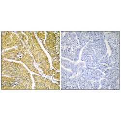 Cytochrome P450 2D6 (CYP2D6) Antibody