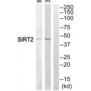 Western blot analysis of extracts from 293 cells and NIH/3T3 cells, using SIRT2 antibody.