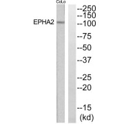 Western blot analysis of extracts from COLO205 and Jurkat cells, using EPHA2 antibody.