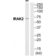 Interleukin 1 Receptor Associated Kinase 2 (IRAK2) Antibody