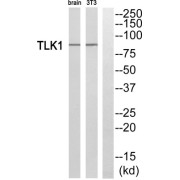 Western blot analysis of extracts from rat brain cells and NIH/3T3 cells, using TLK1 antibody.