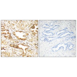 Calcium/calmodulin-Dependent Protein Kinase Kinase 2 (CAMKK2) Antibody