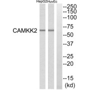 Western blot analysis of extracts from HuvEc cells and HepG2 cells, using CAMKK2 antibody.