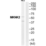 MAP Kinase-Interacting Serine/Threonine-Protein Kinase 2 (MKNK2) Antibody