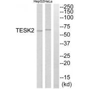 Western blot analysis of extracts from HepG2 cells and HeLa cells, using TESK2 antibody.