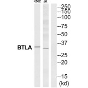 B- And T-Lymphocyte Attenuator (BTLA) Antibody